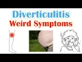 Weird Symptoms of Diverticulitis Atypical Clinical Features of Diverticulitis