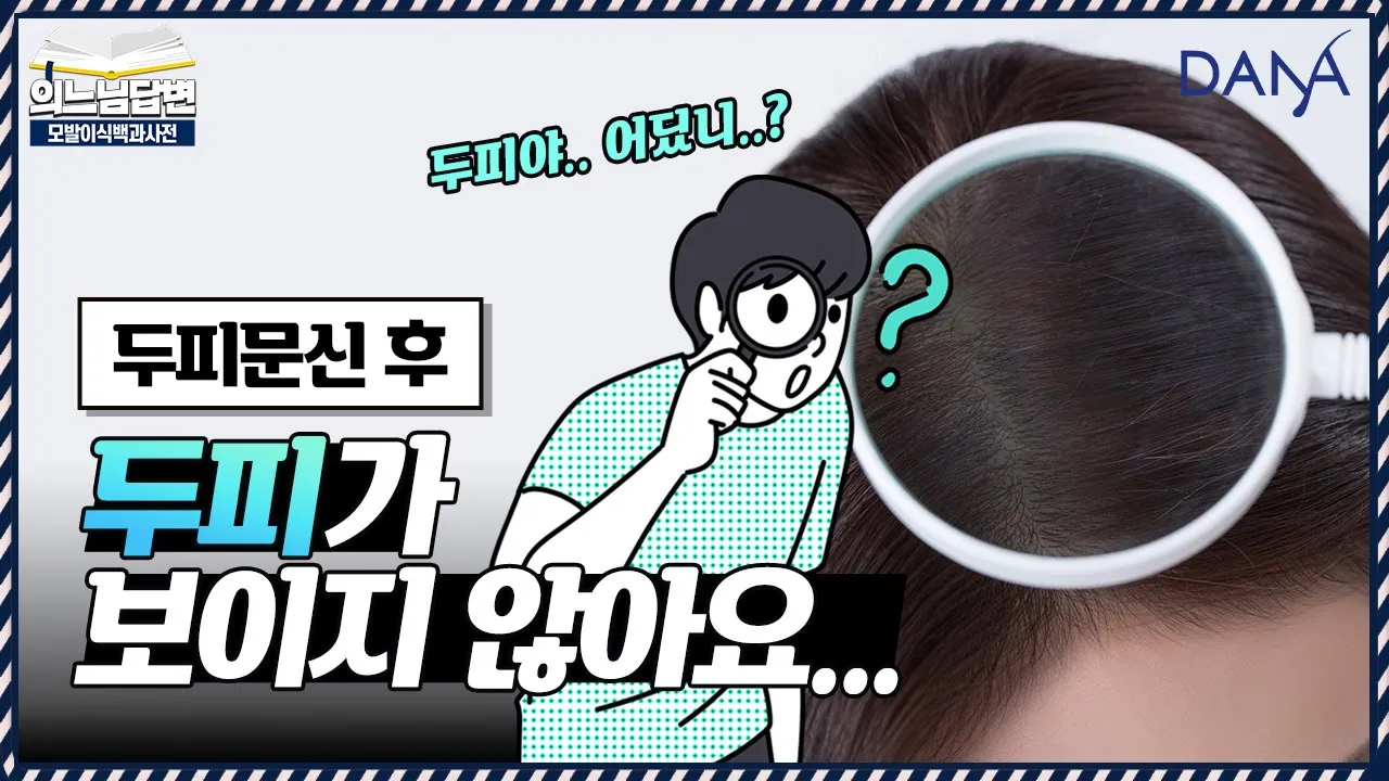 의느님답변📂두피문신🔎두피를 꽉꽉 채운다고 좋은 건 아니에요ㅣ두피문신 받을 때 주의사항ㅣ다나성형외과(DANA)ㅣ모발이식ㅣ헤어라인교정ㅣ두피문신ㅣ탈모치료