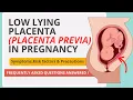 Low Lying Placenta Placenta Previa Explained What Every Pregnant Woman MUST Know