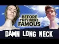 DAMN LONG NECK Before They Were Famous INSTAGRAM STAR