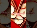 Download Lagu One Apple a Day 🍎 | Best Time to Eat an Apple | Health Tips
