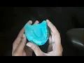 Download Lagu C Clasp Fabrication | Three fourth clasp | Orthodontics | Dental Occlusion