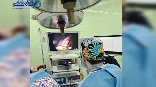 جدا کردن چربی های شکم در عمل اسلیو معده دکتر فربد امامی یگانه 