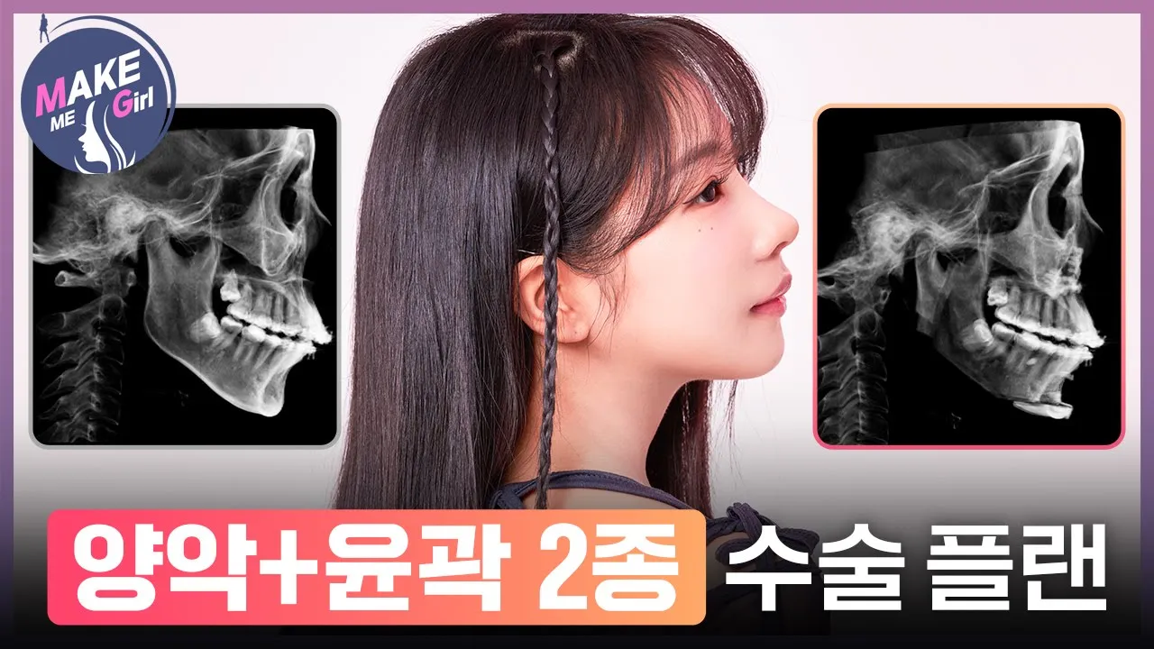 [맥미걸]미운오리새끼 힙채연 양악+윤곽2종 플랜