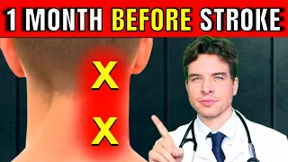 3 Early Warning Signs of a Stroke - Recognize Stroke Symptoms FAST THIS Could Save Your Life