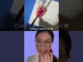 Download Lagu Cutting open a Tonsil to see all the Baby tonsil stones (don’t watch if dissection makes you sick)