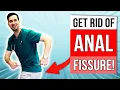 How to get rid of anal fissure treatment at home