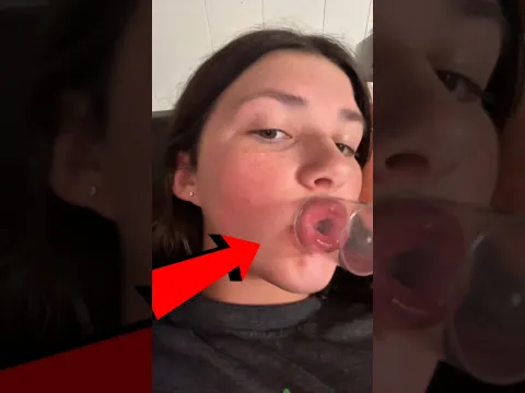 Making Big Lips Mistake 😱🤯|| #short #shortsfeed #viral