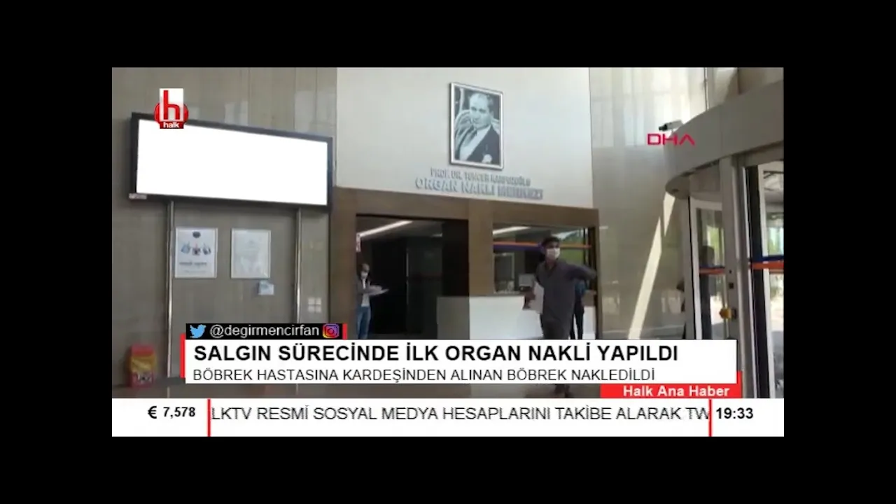 Akdeniz Üniversitesi’nin Organ Nakli Başarısı Dünya’ya Açılıyor. 