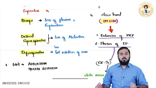 12 Brachial Plexus Injuries Erb s Palsy Vs Klumpke s Palsy