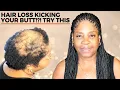 HOW TO BOX BRAID FOR BEGINNERS ALOPECIA VERSION