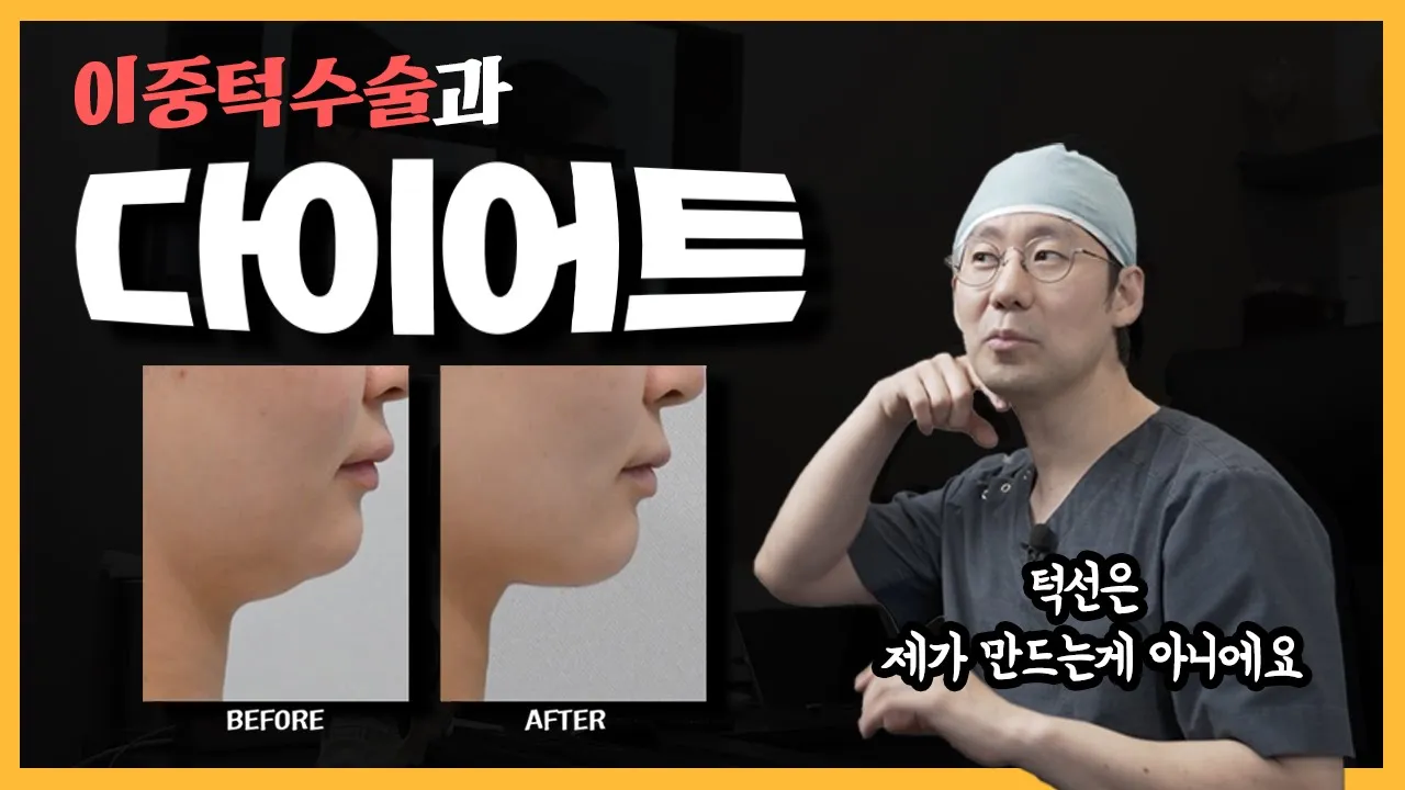 이중턱과 다이어트의 상관관계는??