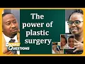 The first female plastic surgeon in Uganda on the Hard Questions show