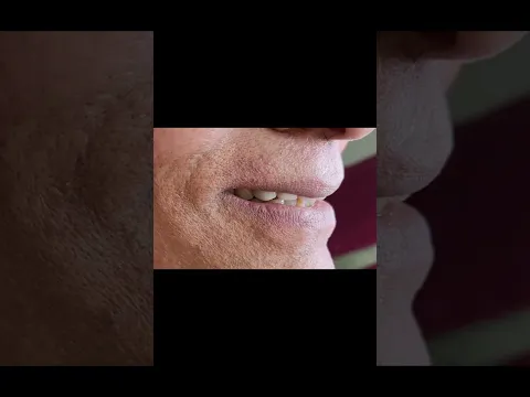 Smile design video testimonial
