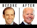 Joe Biden s NEW FACE Plastic Surgery Analysis