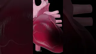 Heart Attack Explained Animation 