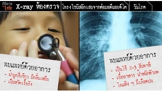 วัณโรคสามารถแพร่กระจายได้อย่างไร และมีวิธีป้องกันอย่างไร