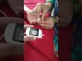 Download Lagu Random blood sugar | RBS |diabetes| glucometer#diabetes