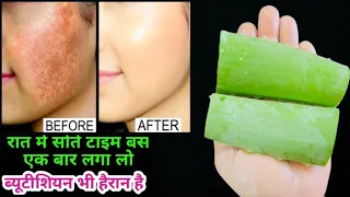 रात में Aloevera इस तरीक़े से लगाओ सुबह चेहरे पर ऐसा गोरापन आएगा आपके होश उड़ जाएंगे SkinWhitening