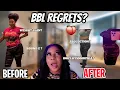 Regrets getting my bbl With Dr William At 305 Plastic Surgery is a bbl worth it 1 year bbl update