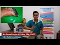 Download Lagu Tips Dan Cara Menghindari Luka Pada Kaki Penderita Diabetes Mellitus