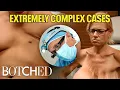 Multiple Trips to the OR The Docs Tackle Extremely Complex Cases Compilation Botched E