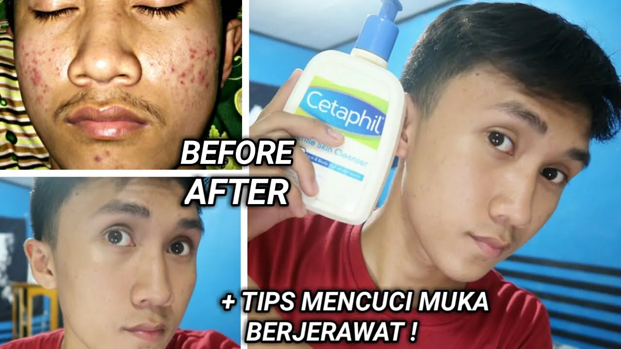 Yang Ngerasa Dekil WAJIB NONTON!!! Tips Mencerahkan Kulit. 