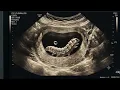 Fake Ultrasound prank
