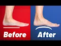 How to Fix Flat Feet 3 SIMPLE Exercises from a Physical Therapist