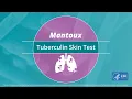 Mantoux Tuberculin Skin Test