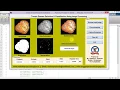 Tomato Disease Detection and Classification Using Image Processing Matlab Project Code