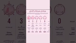 مراحل سرطان الثدي سرطان الثدي مراحل تكوين Trending Explore Fypシ ترند صحة تحاليل طبية تشخيص 