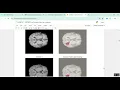 Brain Tumor Detection 2d 3d Image Classification in Python Projects