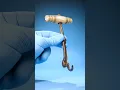 How Teeth Were Extracted In The 1800s ODDLY CALMING