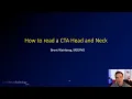 How to read a CT angiogram CTA of the Head and Neck