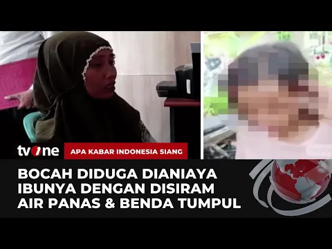 Bocah Perempuan di Padang Pariaman Dianiaya Ibu Kandung, Alami Luka di Sekujur Tubuh