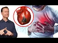 The Best Remedy to Prevent a Heart Attack for 3 19