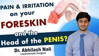most common cause of balanitis balanoposthitis symptoms dr abhilash nali