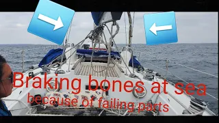 Breaking bones at sea while sailing around the UK
