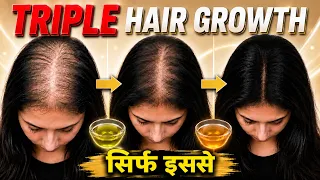 15 दिनों में 3X Hair Growth Activation Challenge-सिर्फ इन 5 चीज़ों से-Stop Thinning & Regrow 3X Hair