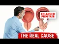 Enlarged Prostate and Urination Problems Explained by Dr Berg
