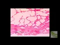 SLIDE Adipose Tissue