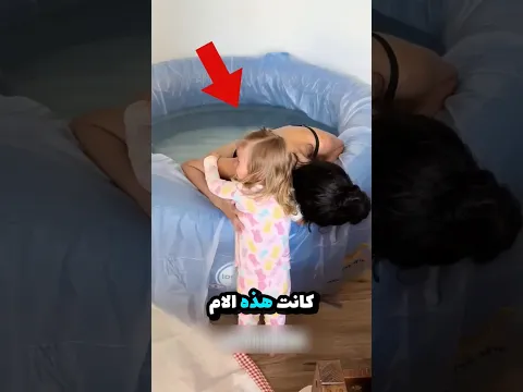 لن تُصدّق كيف تغيّر هذا الطفل بعد العملية! 😭❤️✨ #dontgetscared #اكسبلور #الظروف