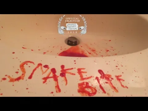 SNAKE BITE