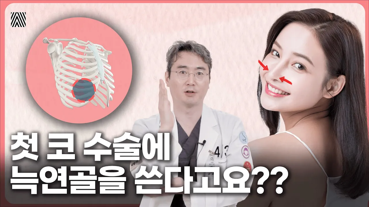 '늑연골'을 사용한 코 성형의 모든 것!! 이거 알려주는 병원 별로 없습니다.. 늑연골 1편_[4월31일 성형외과]