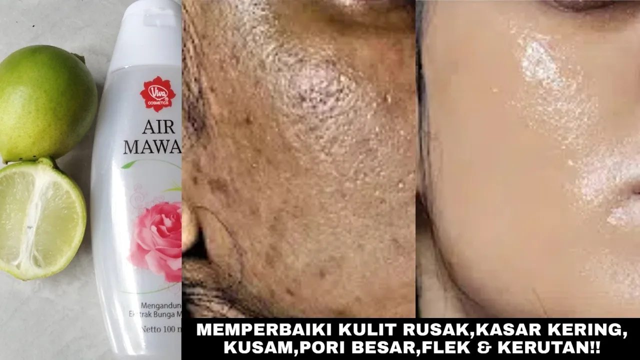 CARA AMPUH MENGATASI KULIT KERING PADA WAJAH SECARA ALAMI | 2x Pakai Langsung Lembab. 