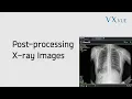 VXvue Quick Guide 03 Post-processing X-ray Images