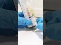 Download Lagu urine reagent strips #urinalysis #urine #medtechstudent #medtech #laboratory #clinicalmicroscopy