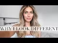 WHY I LOOK DIFFERENT Lydia Elise Millen