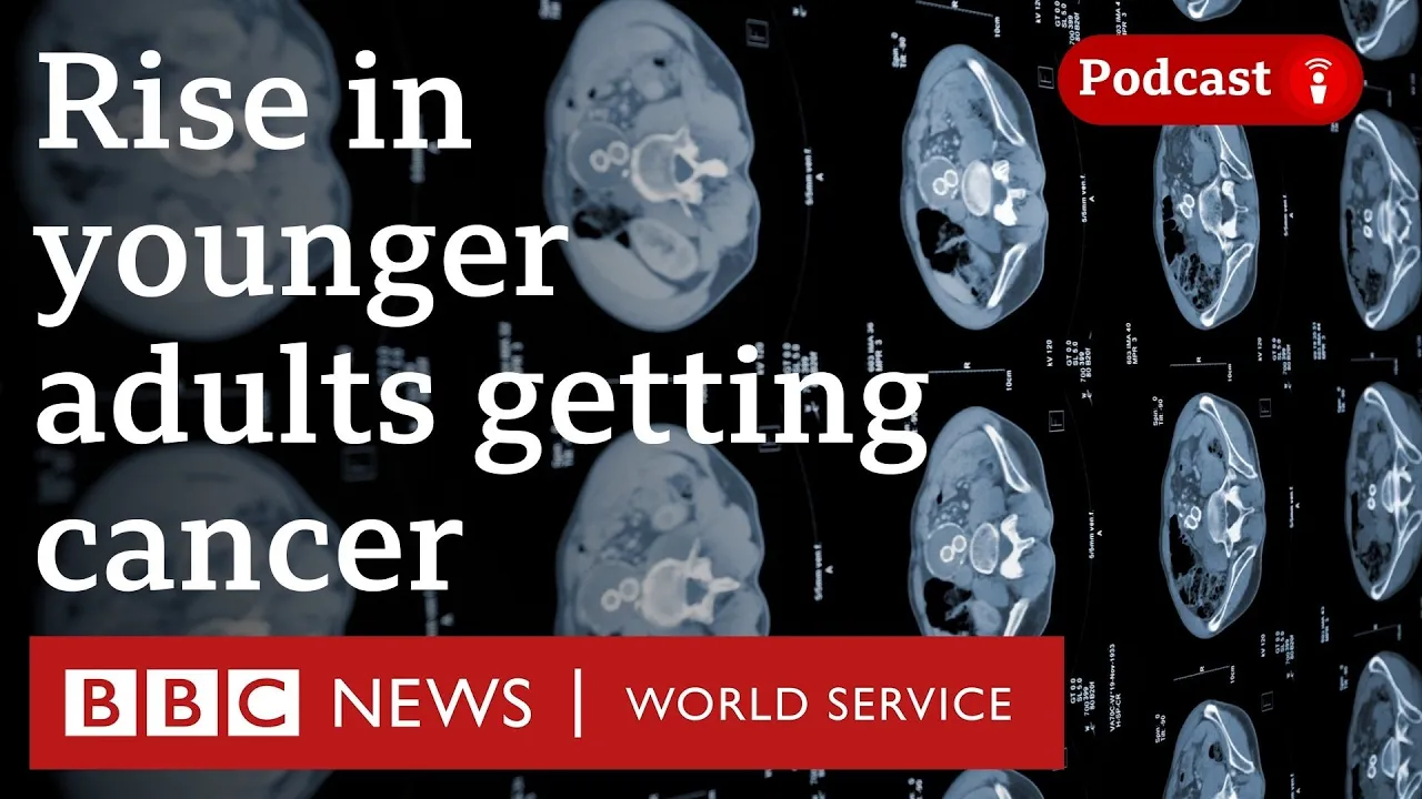 Outline Video Why are more adults than ever getting cancer younger? - The Global Story podcast, BBC World Service